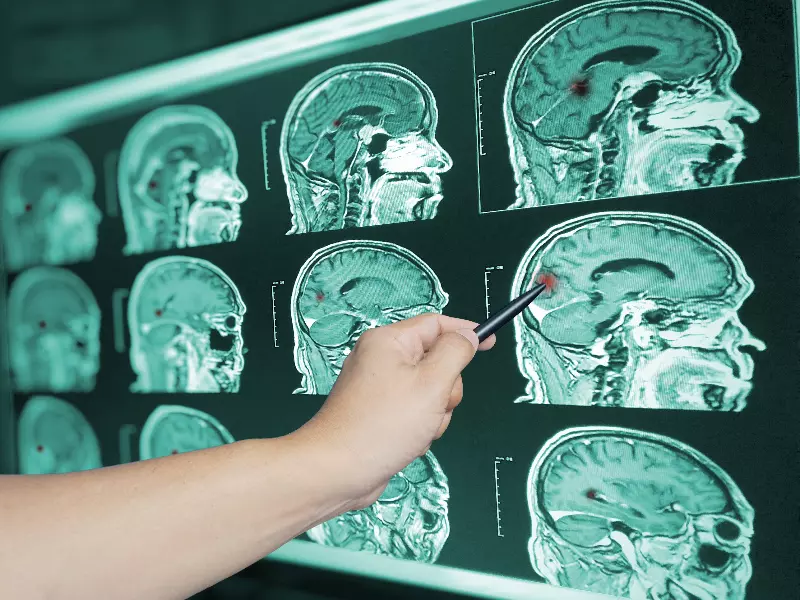 Concussion Treatment Near Me in Bloomfield Hills, MI. Chiropractic Consultation for Concussion Symptom Relief.