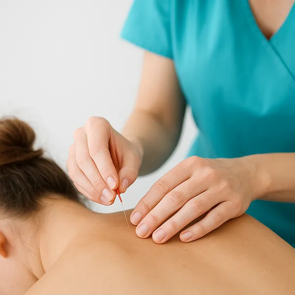 Dry Needling Therapy Treatment Near Me in Bloomfield Hills, MI. Chiropractor For Dry Needling.