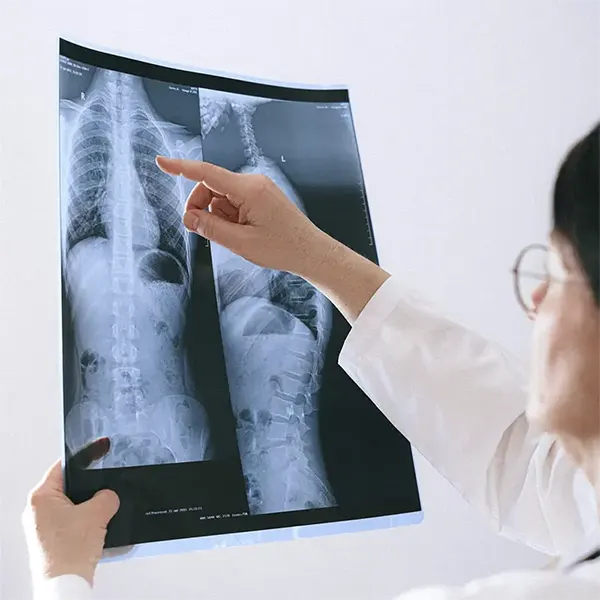Scoliosis Treatment Near Me in Bloomfield Hills, MI. Chiropractor For Scoliosis Pain Relief.